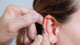 O-que-é-acupuntura-auricular